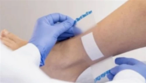 Applications Of Medical-grade TPU Film: Wound Dressings, Surgical Drapes, And...
